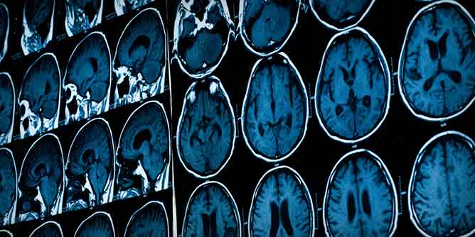 Series of MRIs taken of the human brain during sex